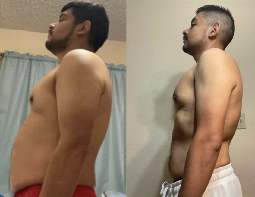 Andrew before and after