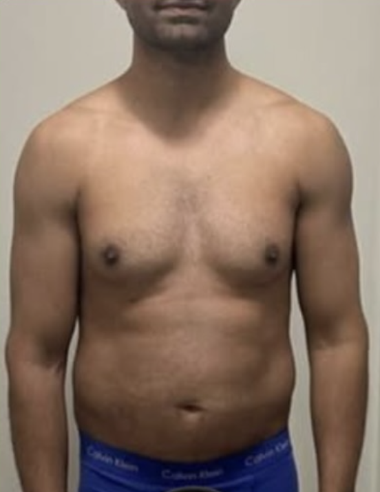 Nitin before